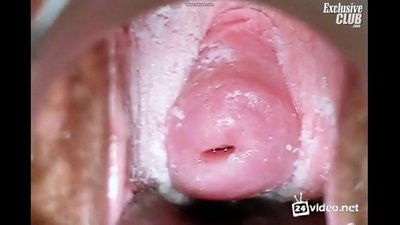 Gynecological ûndersyk fan in moaie frou
